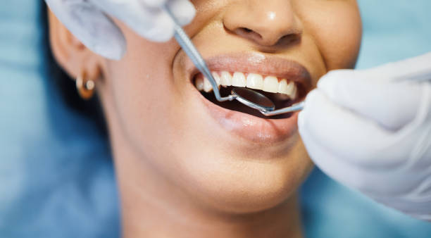 Best Emergency Pediatric Dental Care in Bellefontaine, OH
