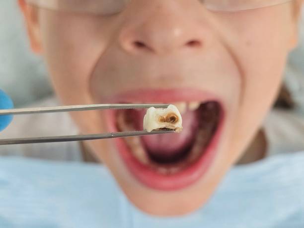Best Emergency Denture Repair in Bellefontaine, OH